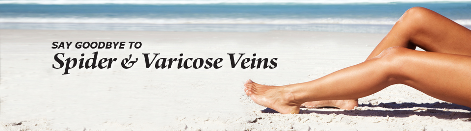 Varicose Veins and Spider Veins Pocatello Idaho treatements in Pocatello Idaho